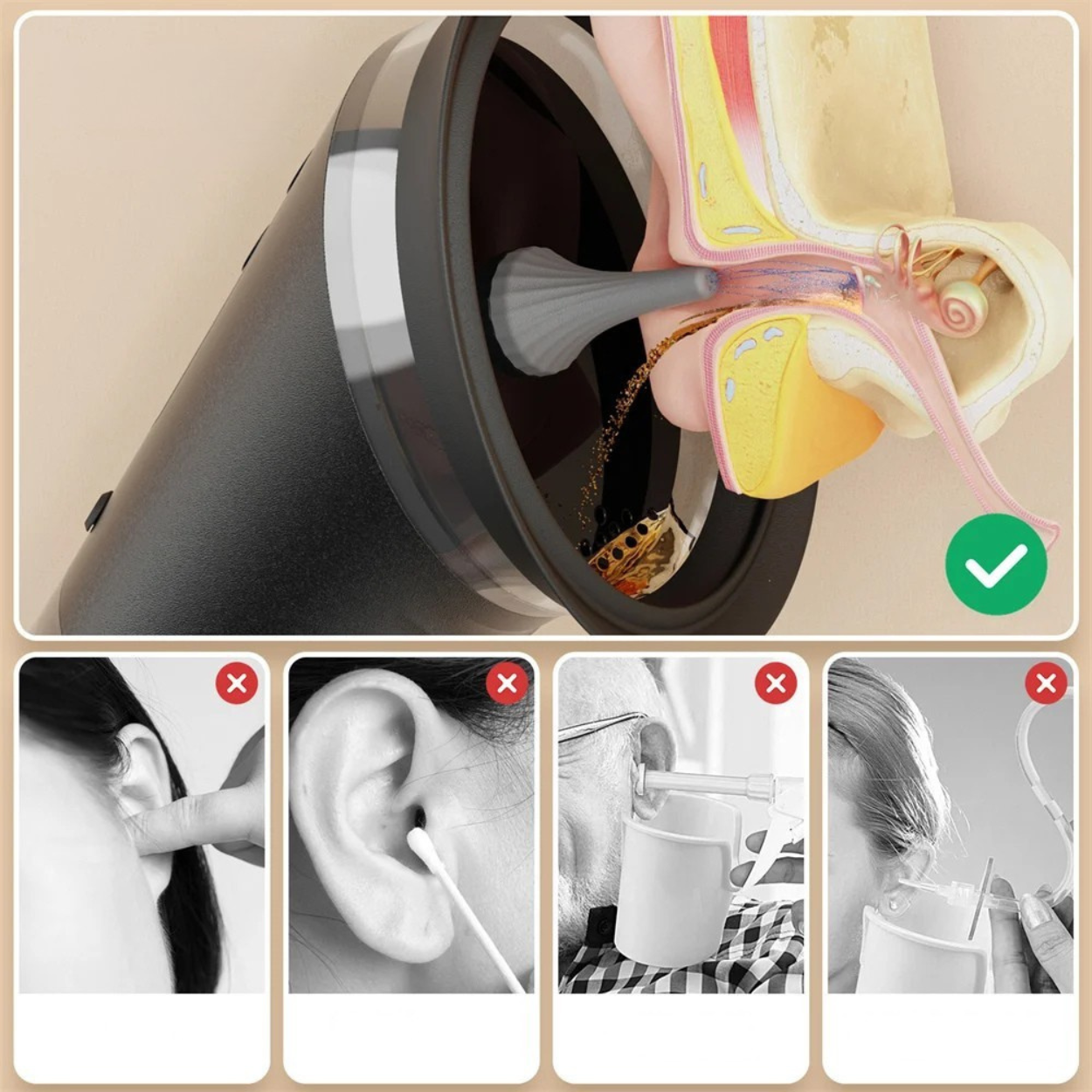 Nettoyeur d'Oreille Électronique pour Enlever le Cérumen